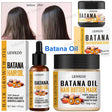 Collection of Lewedo Batana Oil hair care products with before and after images.