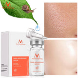 MeiYanQiong snail nourishing serum with packaging, snail on leaf, and skin before and after application.