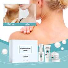 Acanthosis Nigricans Skin Repair and Whitening Set before and after neck comparison showing skin lightening results.