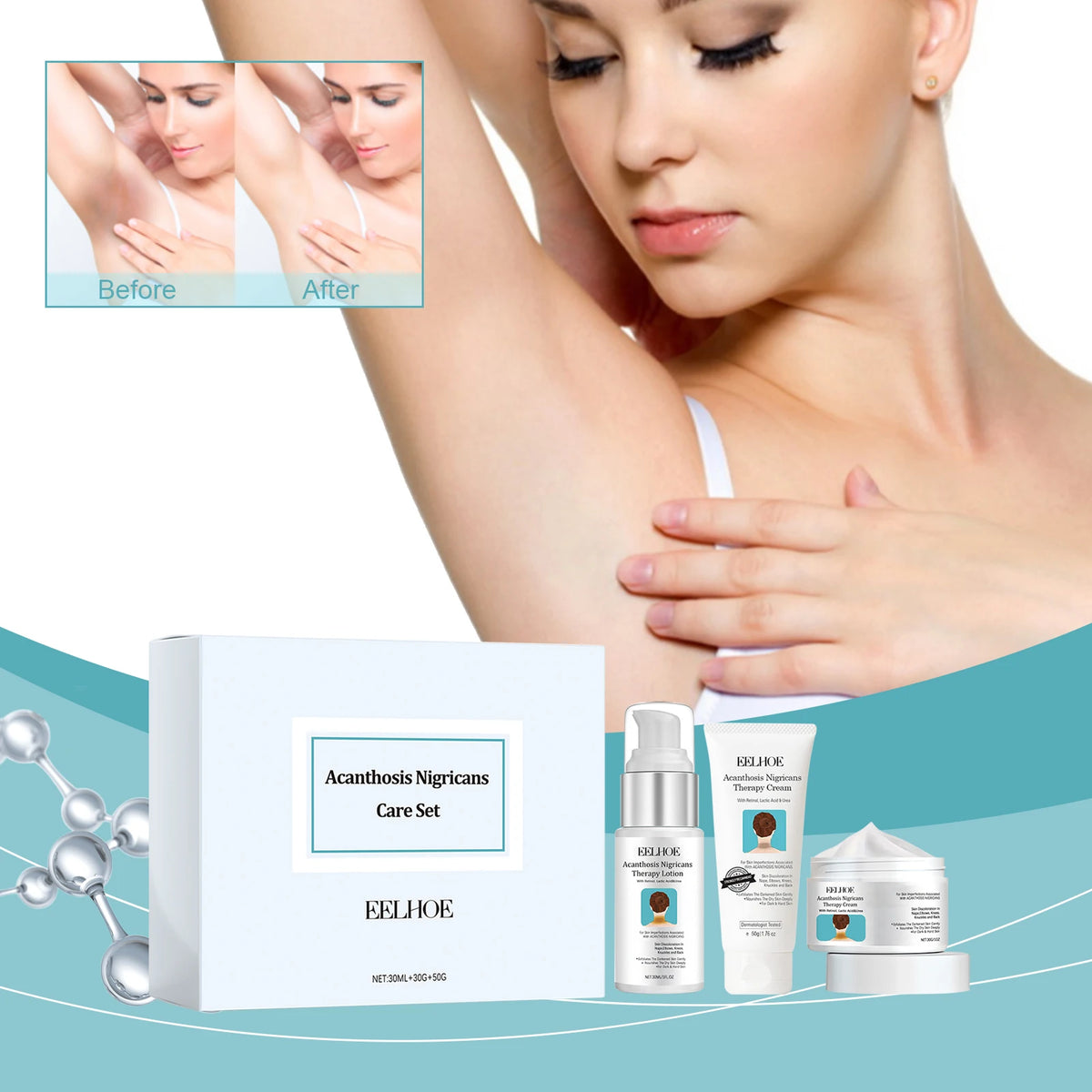 Acanthosis Nigricans Skin Repair and Whitening Set before and after comparison on white background.
