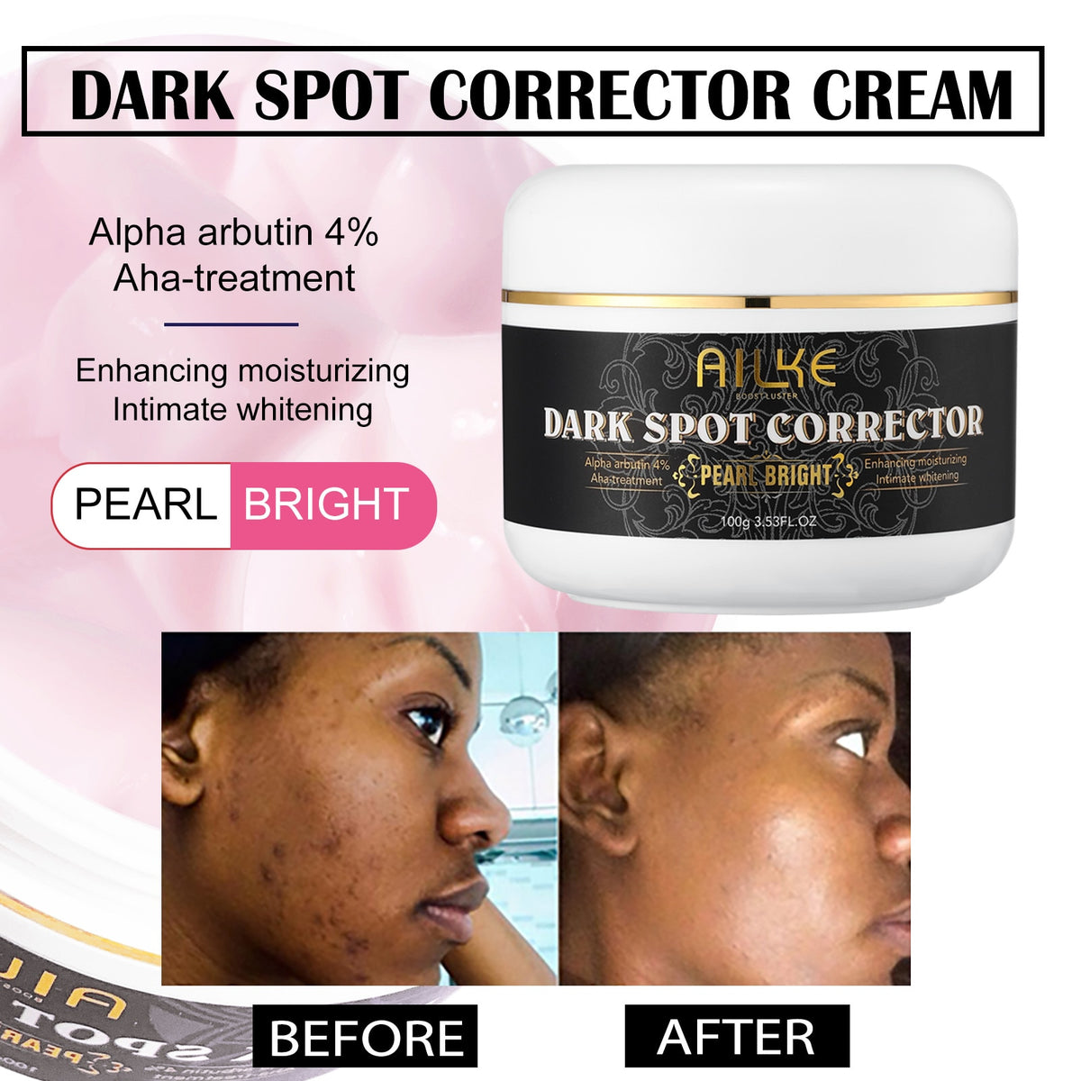 AILKE Bleaching Whitening Anti-Wrinkle Lotion Cream brightening results for clear radiant complexion.