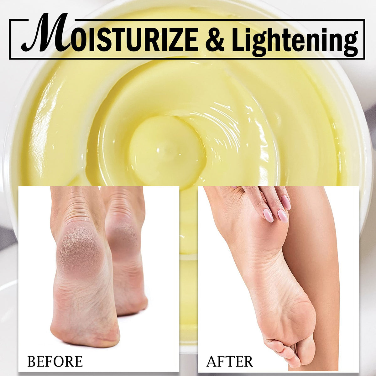 AILKE Bleaching Whitening Anti-Wrinkle Lotion Cream full product display showcasing complete formula.