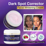 AILKE Double Glutathione Whitening Skin Care Kit dark spot corrector cream with before and after images on purple background.