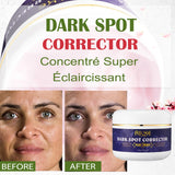 AILKE Glutathione 5-in-1 Women Skin Care Kit for even skin tone and complexion improvement.