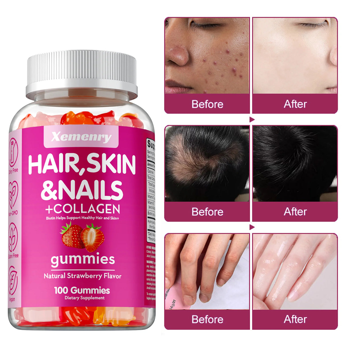 High Potency Biotin Gummies for Hair, Skin & Nails showing before and after benefits for hair strength and skin care.