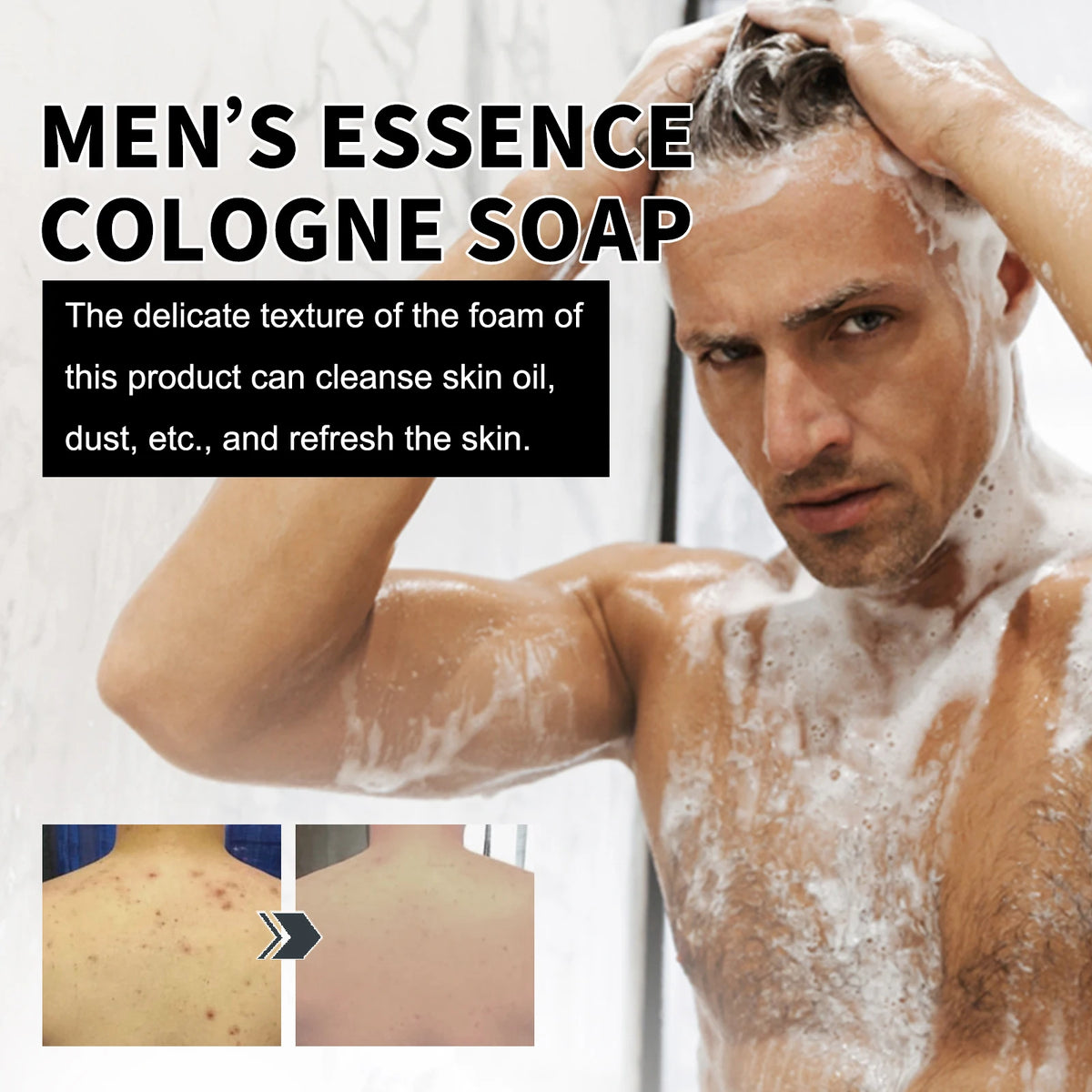 East Moon Niacinamide Whitening Acne-Fading Soap man applying bar with key benefits displayed.