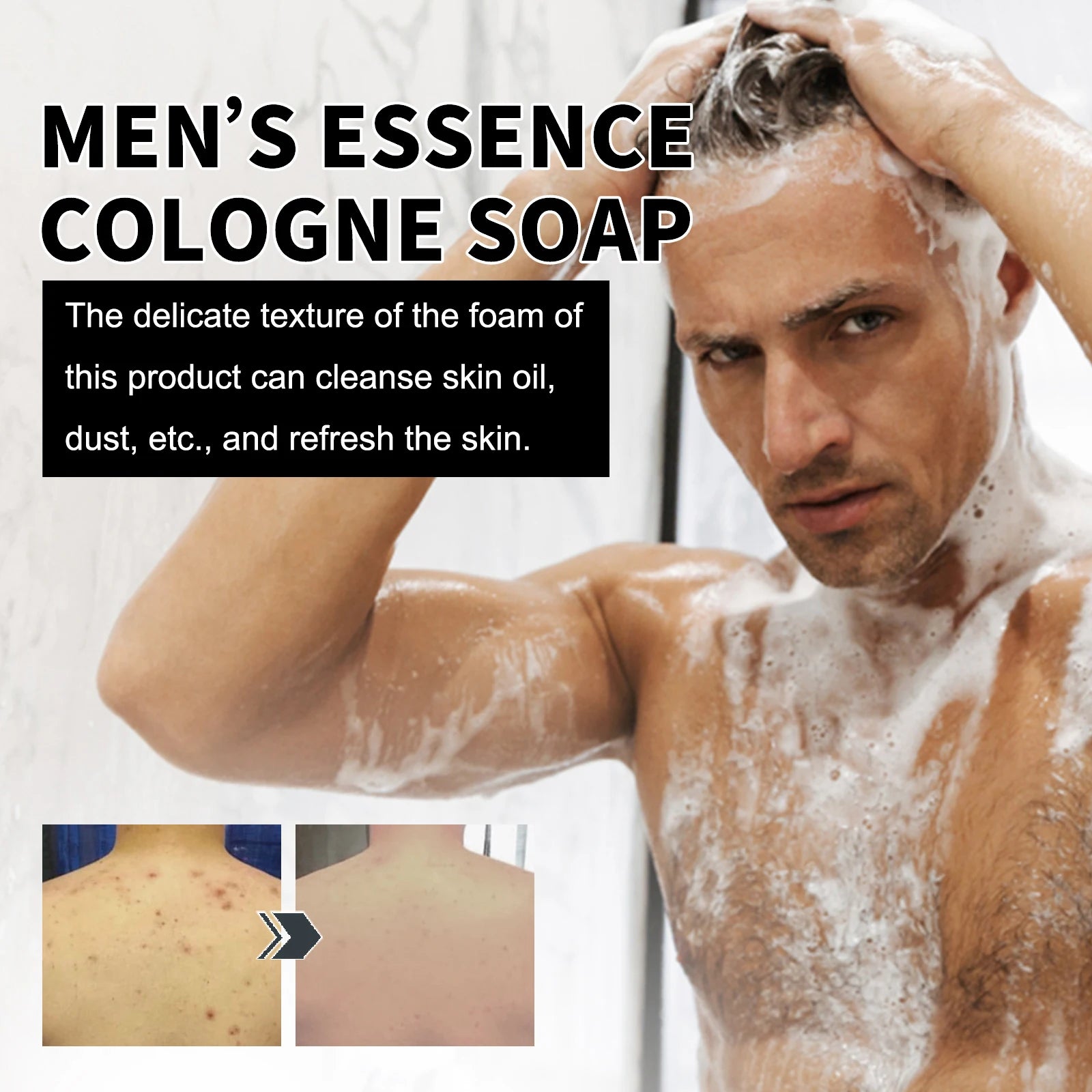 East Moon Niacinamide Whitening Acne-Fading Soap man applying bar with key benefits displayed.