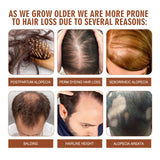 Eelhoe Pure Organic Batana Oil Hair Growth Mask infographic on hair loss causes with images and text.