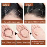 Eelhoe Pure Organic Batana Oil Hair Growth Mask before and after showing hairline improvement and hair growth.