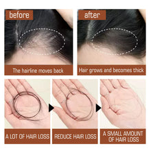 Eelhoe Pure Organic Batana Oil Hair Growth Mask before and after showing hairline improvement and hair growth.