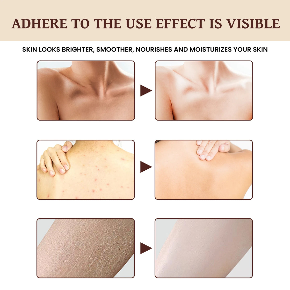 EELHOE Coffee Scented Anti-Aging Body Lotion before and after comparison showing improved skin texture.