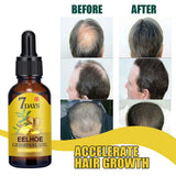 eelhoe Ginger Hair Regrowth and Scalp Treatment Oil before and after comparison showing improved hair growth and density.