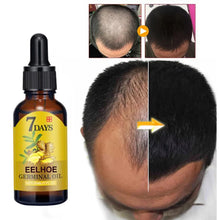 eelhoe Ginger Hair Regrowth and Scalp Treatment Oil showing before and after hair growth results on white background.