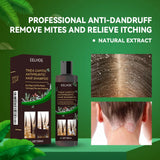 Eelhoe Natural Herbal Anti-Dandruff Shampoo packaging with dandruff relief benefits on green background.