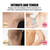 Eelhoe Skin Whitening Soap before and after leg treatment for dark spot removal on knees and joints.
