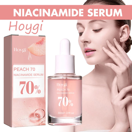 Hoygi Niacinamide Face Serum bottle for fading the look of dark spots, smoothing skin, and enhancing daily glow.