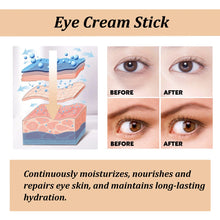 Hoygi Snail Collagen Eye Stick for lightening dark circles, calming puffiness, and nourishing delicate under-eye skin.