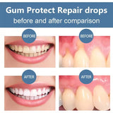 Jay-Suing Damaged Gum Repair Deep Cleaning Gel before and after comparison showing gum restoration results.