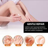 Jaysuing Bamboo Charcoal Whitening Soap before and after leg treatment for dark skin patches.