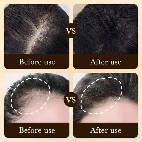 Men’s biotin hair growth scalp oil serum bottle for nourishing the scalp, supporting stronger-looking hair, and everyday grooming.