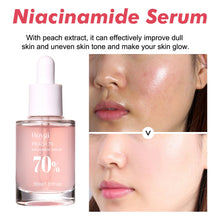 Hoygi Niacinamide Face Serum bottle for brightening dull skin, improving radiance, and daily facial treatment.