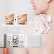 OCEAURA Donkey Milk Whitening Soap before and after skin comparison for brightening daily cleanse.