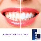 Purple Teeth Whitening Toothpaste 30ml before and after comparison showing yellow tone correction.