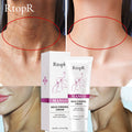RtopR Mango Neck Firming & Anti-Wrinkle Cream 40g packaging with before and after neck skin effects display.