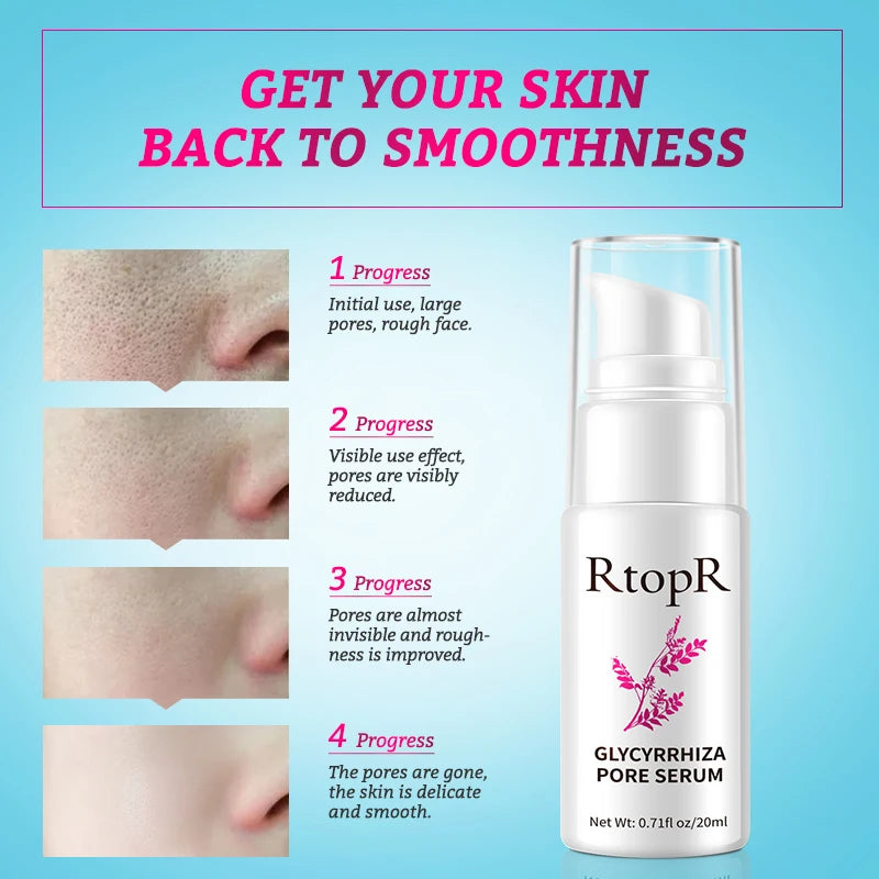 RtopR Pore Shrinking & Repair Essence skin before and after improvement results on blue background.