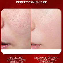 SAUVASINE Dragon Blood Retinol Cream before and after comparison showing visible skin improvement with regular use.