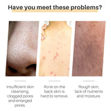 SAUVASINE Turmeric Soap skin benefits for dark spots, uneven tone, and dull skin infographic.