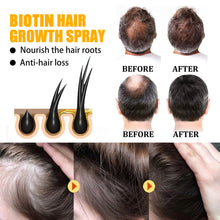 Scalp Nourishing Biotin Hair Spray bottle for moisturizing dry scalp, refreshing hair roots, and everyday hair treatment use.