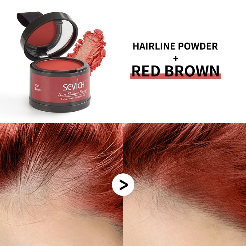 Sevich Waterproof Hairline Powder giving confident polished hairline look.