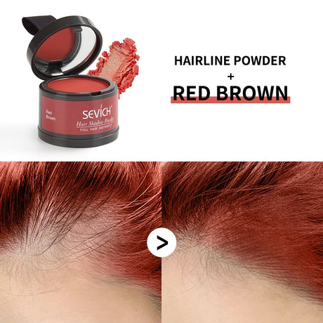 Sevich Waterproof Hairline Powder giving confident polished hairline look.