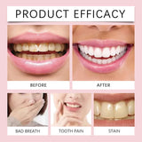 SP-6 Probiotic Whitening Toothpaste before and after comparison of teeth whitening efficacy.