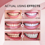 SP-6 Probiotic Whitening Toothpaste showing before and after whitening results on pink background.