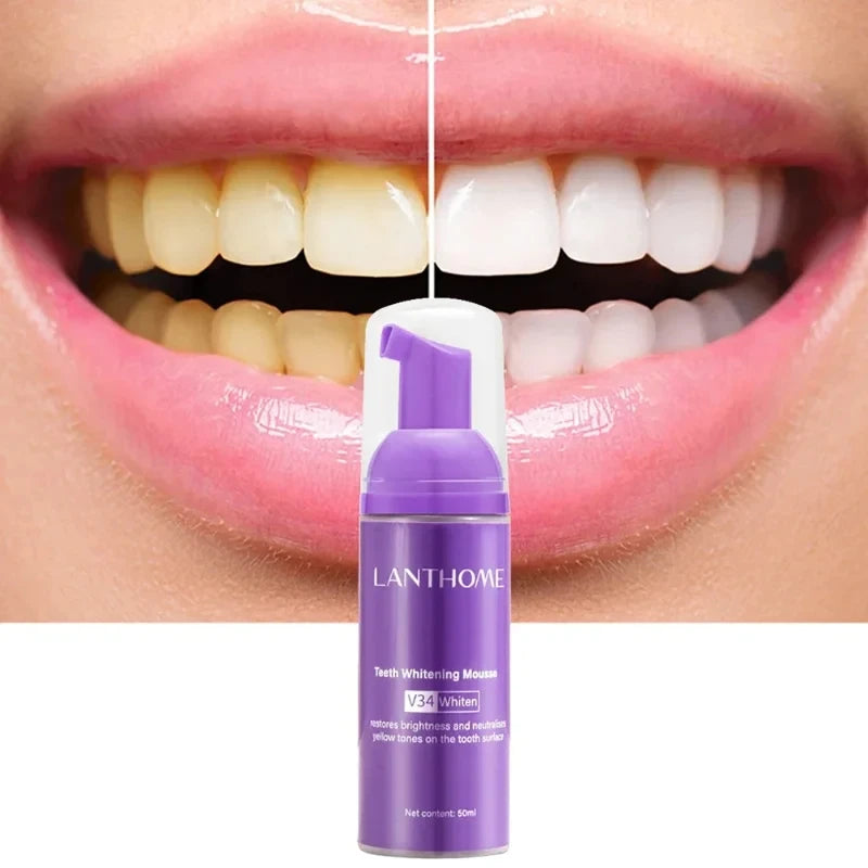 V34 Mousse Toothpaste whitening foam before and after teeth whitening comparison results.