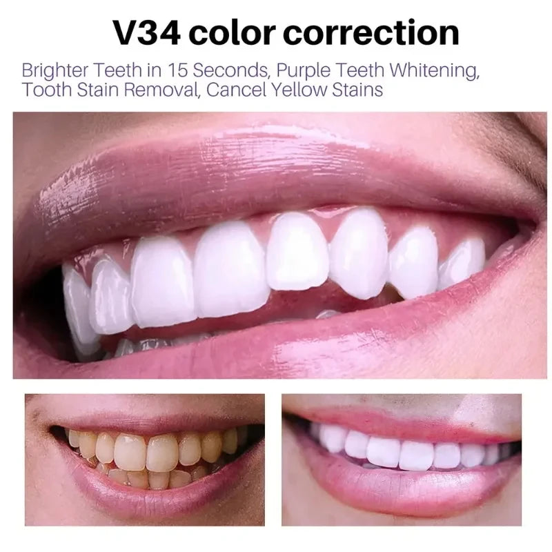 V34 Mousse Toothpaste whitening foam showing before and after results for a brighter smile.