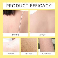 Before and after skin comparison on a person's shoulder showing Viareline Floral Scent Body Wash Gel efficacy.