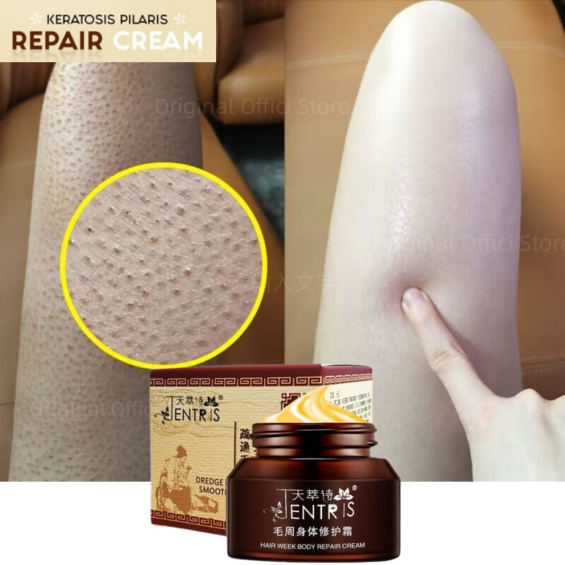 Keratosis Pilaris Skin Repair Cream