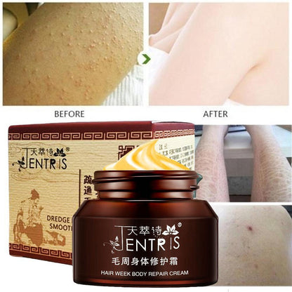 Keratosis Pilaris Skin Repair Cream
