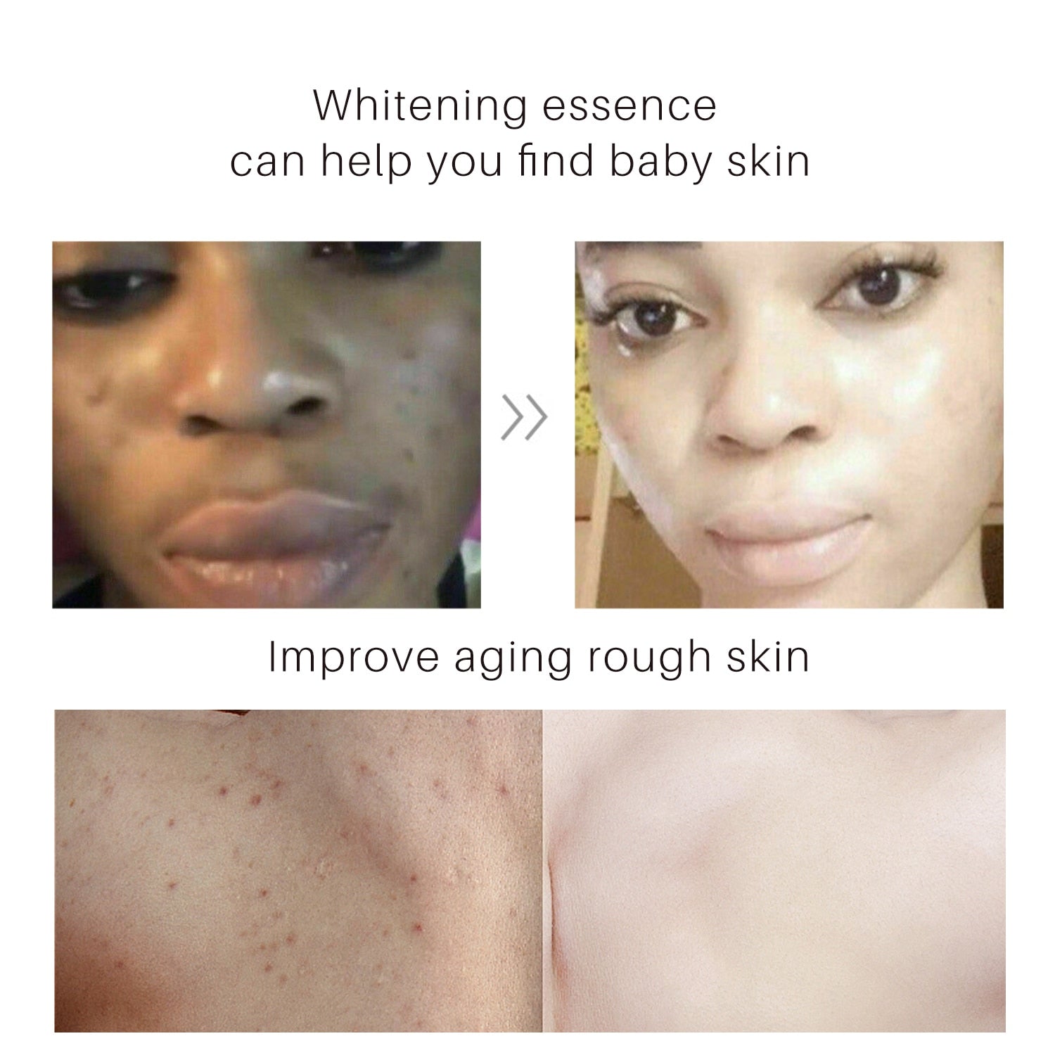 Turmeric Anti Aging Skin Lightening Cream
