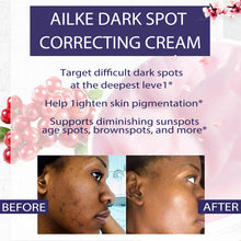 AILKE Dark Spots Remover Cream before and after comparison showing reduced dark spots and brighter skin tone.
