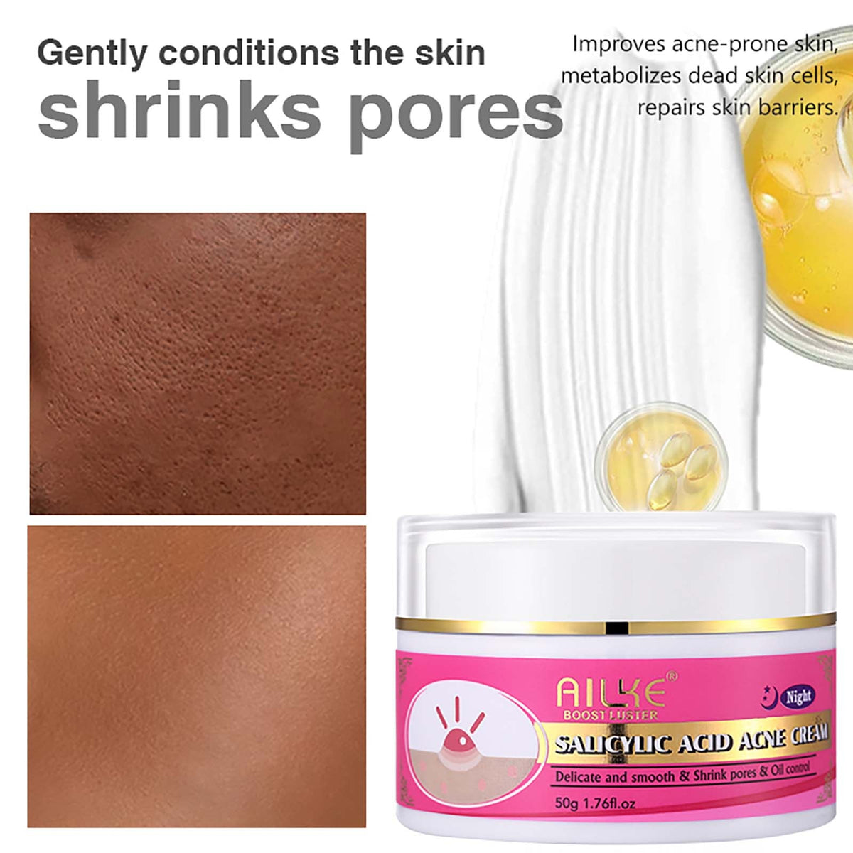 AILKE Organic Salicylic Acid Acne Cream packaging close up showing cruelty-free non-comedogenic formula.