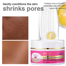 AILKE Organic Salicylic Acid Acne Cream packaging close up showing cruelty-free non-comedogenic formula.
