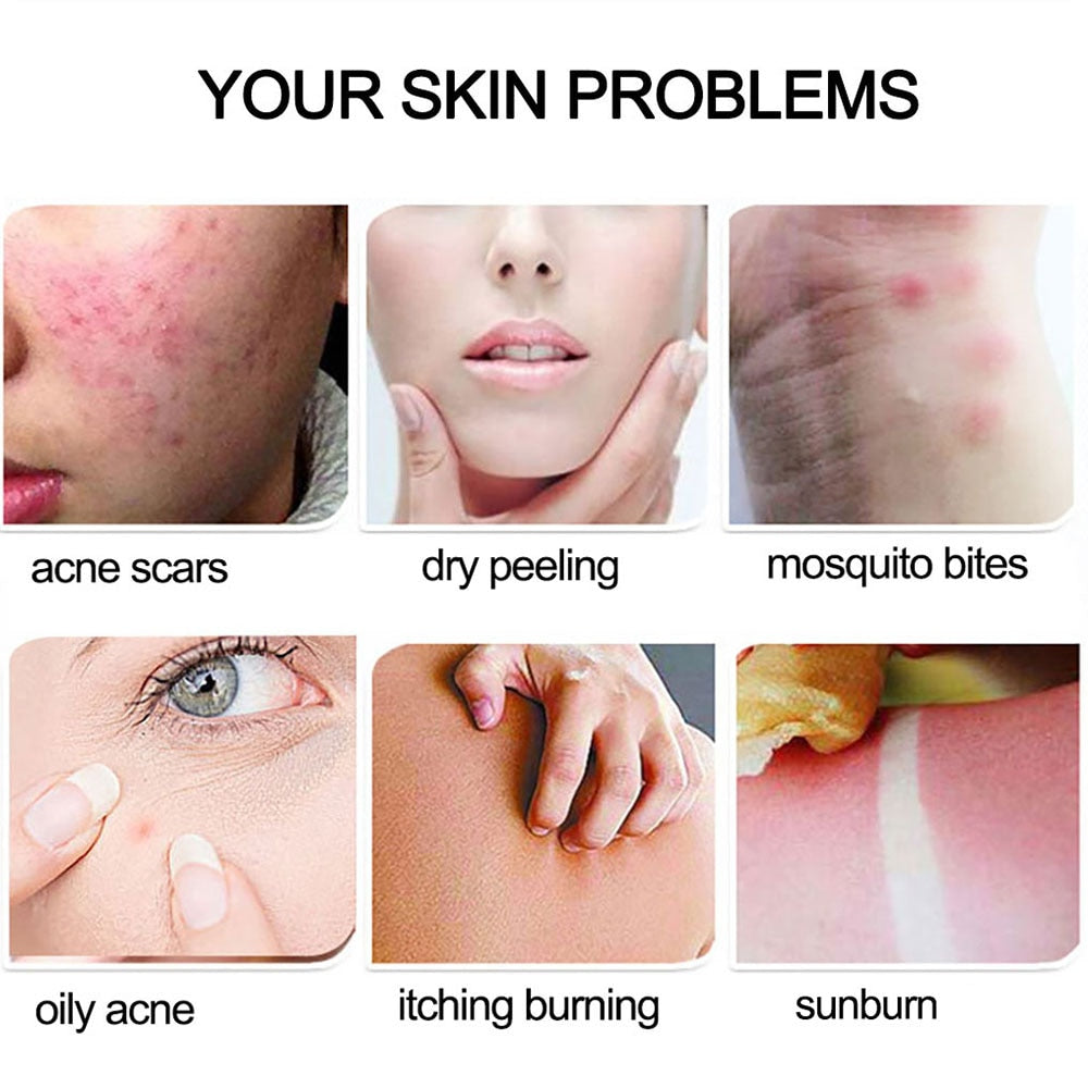 Aloe Vera Gel Moisture Face Cream key ingredients with aloe vera plant and botanical elements.