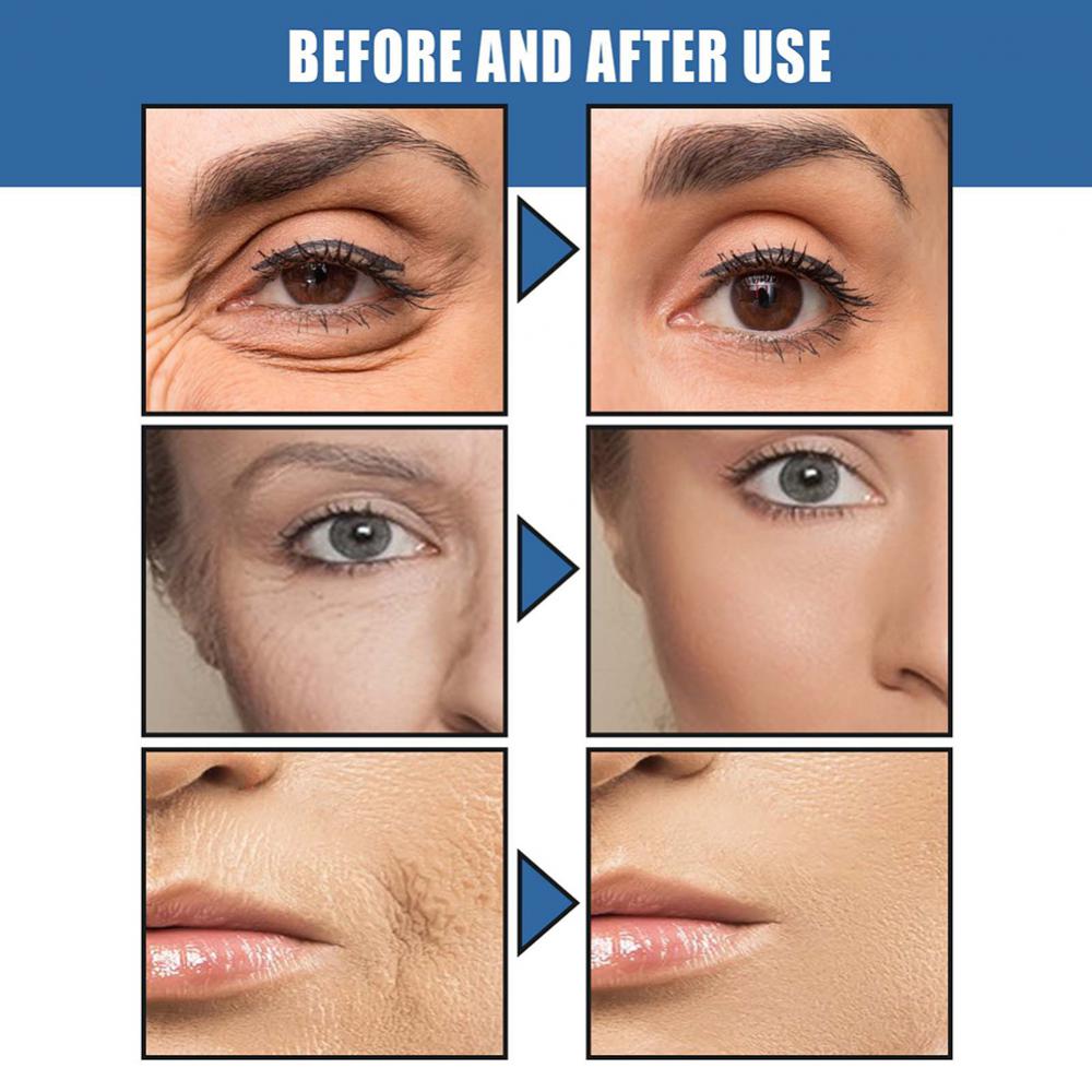 Anti-Aging Firming Lifting Fade Fine Line Face Cream before and after fine line reduction results.