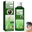 Ginger Anti-Dandruff Shampoo 100ml bottle for men and women on white background.
