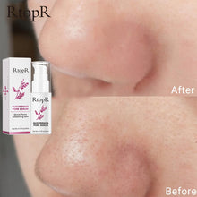 Glycyrrhiza Face Pore Repair Serum licorice extract and pore-refining ingredients display.
