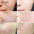 Glycyrrhiza Face Pore Repair Serum main product bottle on white background.